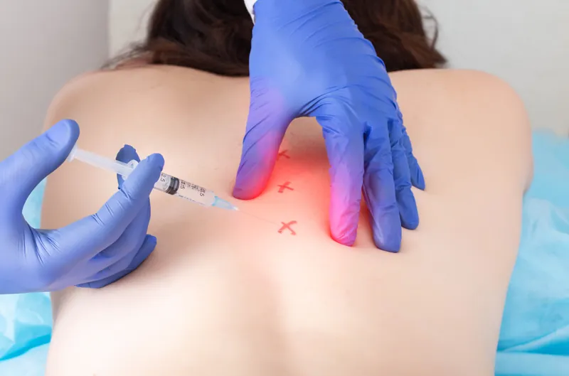 Mesoterapia Antalgica Treatment